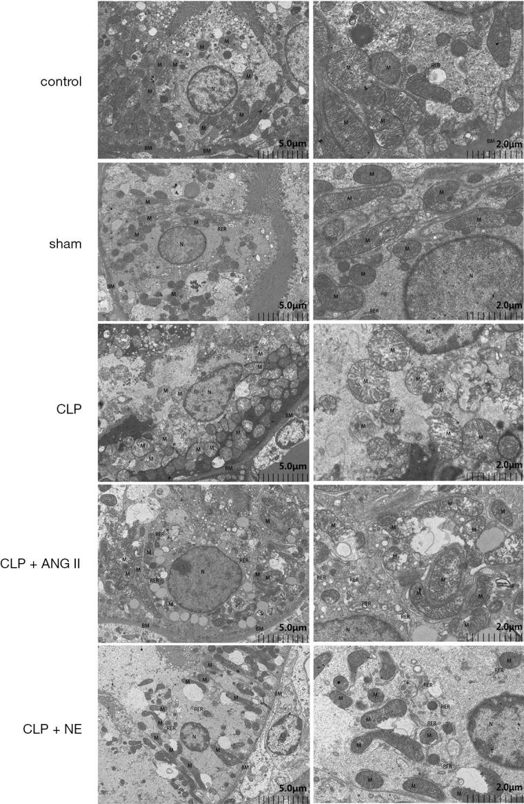 https://cdn.ncbi.nlm.nih.gov/pmc/blobs/03c4/8039700/a8eab9a58c00/atm-09-06-481-f6.jpg