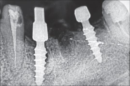 https://cdn.ncbi.nlm.nih.gov/pmc/blobs/03c5/11805029/6f3d3cc9520e/JPBS-16-3655-g001.jpg