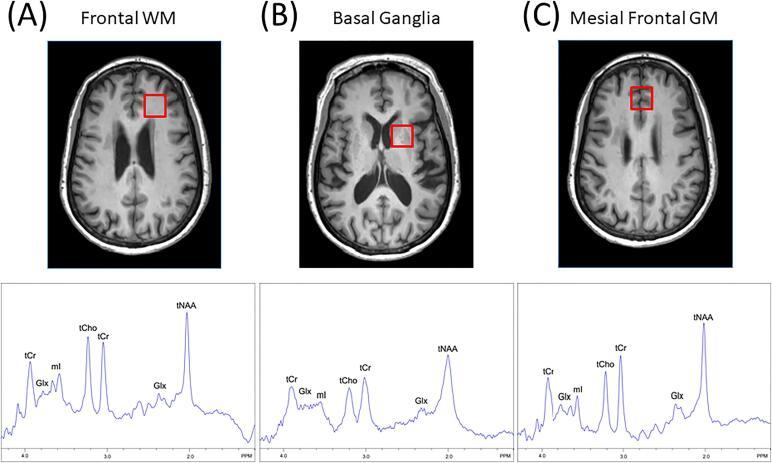 https://cdn.ncbi.nlm.nih.gov/pmc/blobs/03d2/7596344/cb964ef29c7a/gr2.jpg