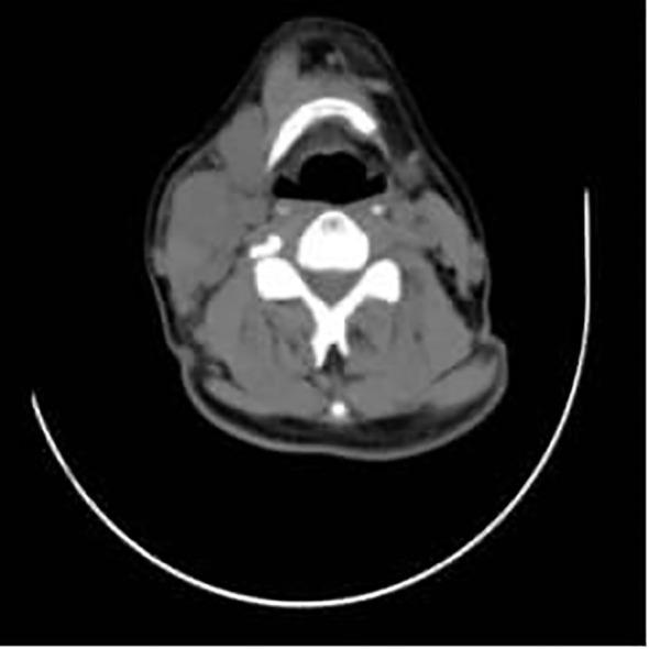 https://cdn.ncbi.nlm.nih.gov/pmc/blobs/03d9/12404991/e1474a76b25b/fonc-15-1464426-g004.jpg