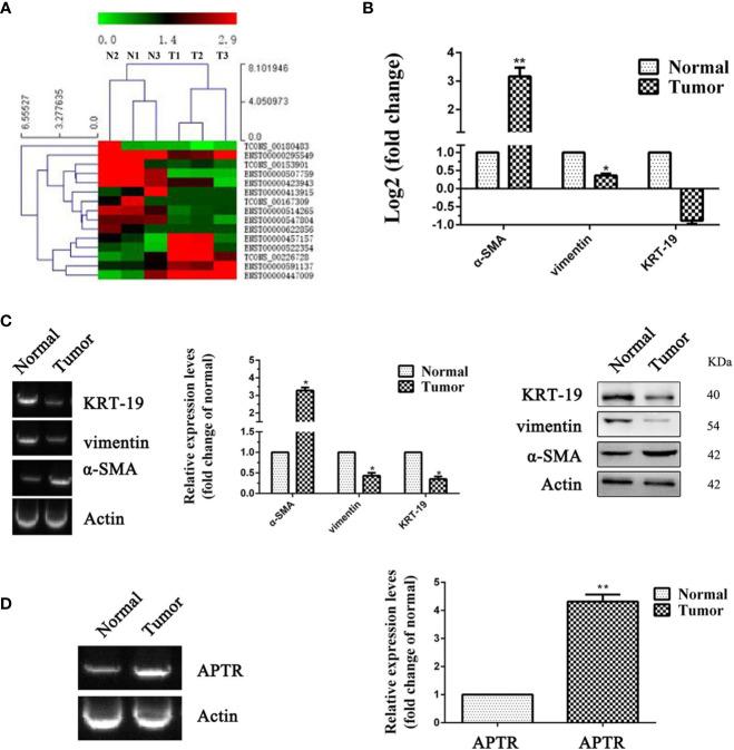 https://cdn.ncbi.nlm.nih.gov/pmc/blobs/03de/7989393/fdd3da3c9f82/fonc-11-536346-g001.jpg