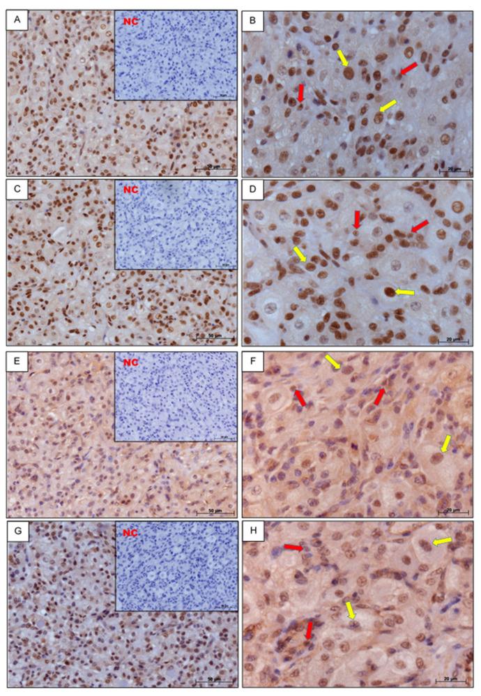 https://cdn.ncbi.nlm.nih.gov/pmc/blobs/03df/7465684/2b943fd9a285/genes-11-00923-g001.jpg