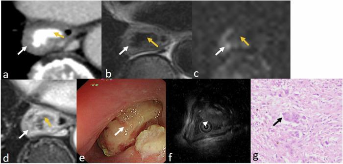 https://cdn.ncbi.nlm.nih.gov/pmc/blobs/03e2/11227487/8247f04222da/13244_2024_1754_Fig6_HTML.jpg