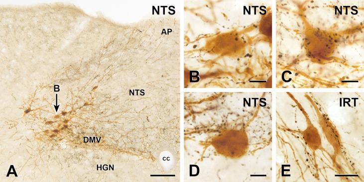https://cdn.ncbi.nlm.nih.gov/pmc/blobs/03e9/5518719/9821cf9d2cda/gr1.jpg