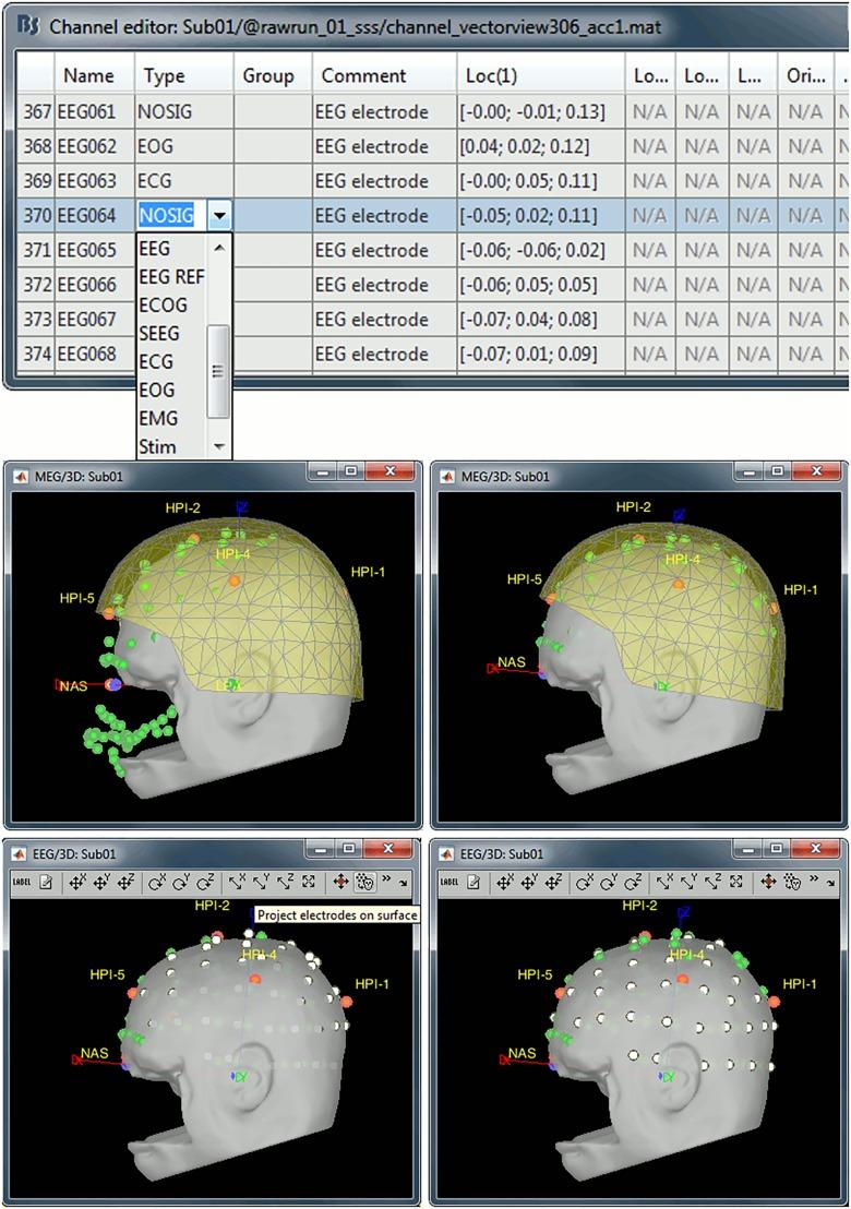 https://cdn.ncbi.nlm.nih.gov/pmc/blobs/03ea/6378958/1ebf96aa3c3c/fnins-13-00076-g002.jpg