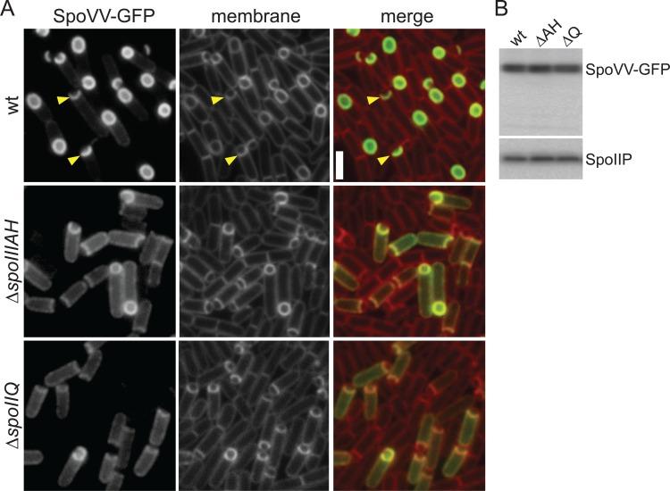 https://cdn.ncbi.nlm.nih.gov/pmc/blobs/03ed/5629000/c8a59b065380/pgen.1007015.g002.jpg