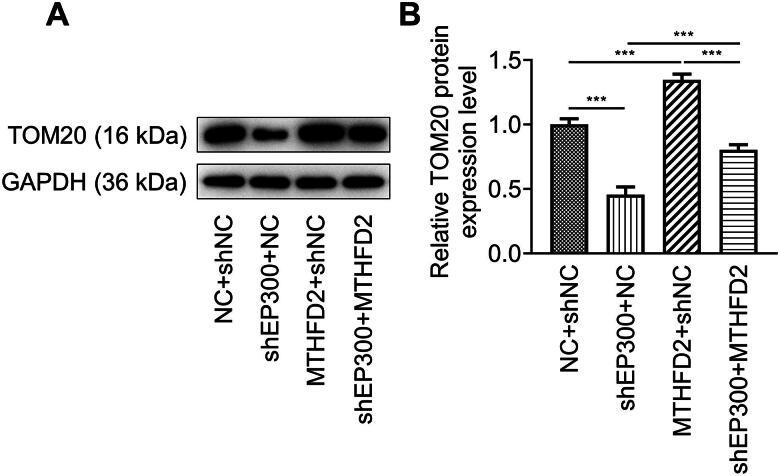https://cdn.ncbi.nlm.nih.gov/pmc/blobs/03ee/11376309/e637b464c27d/IRNF_A_2369342_F0005_B.jpg