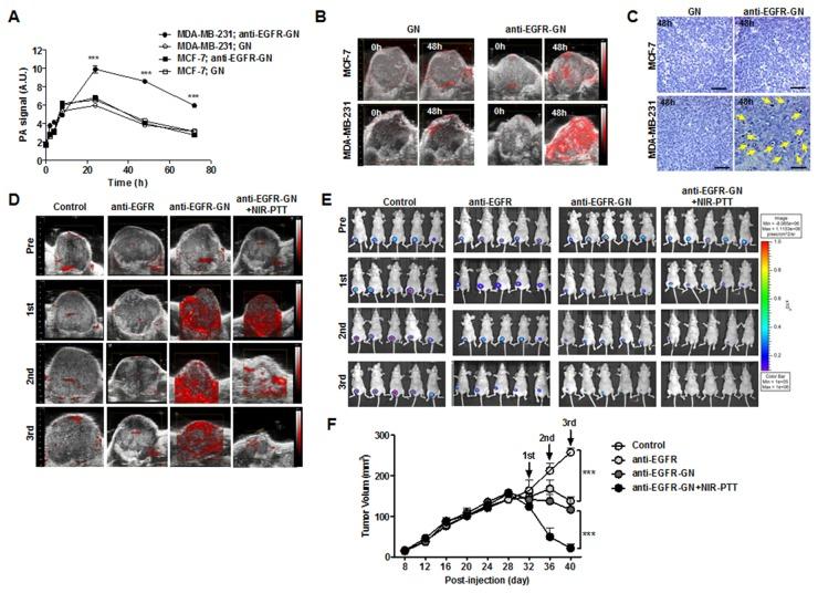https://cdn.ncbi.nlm.nih.gov/pmc/blobs/03f7/5689707/7ffa75bc937f/oncotarget-08-86566-g003.jpg