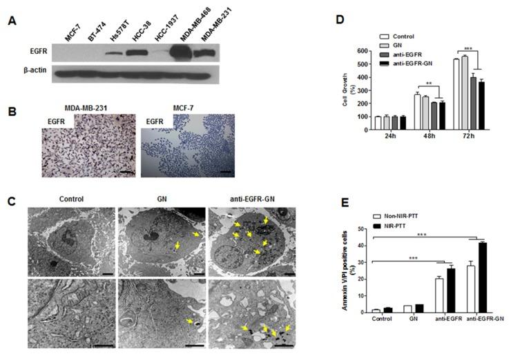 https://cdn.ncbi.nlm.nih.gov/pmc/blobs/03f7/5689707/daca6b6443de/oncotarget-08-86566-g001.jpg