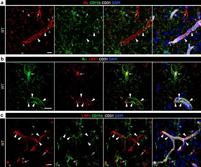 https://cdn.ncbi.nlm.nih.gov/pmc/blobs/0401/5587628/e5c64ec1a51f/401_2017_1749_Fig3_HTML.jpg