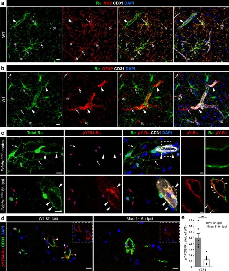 https://cdn.ncbi.nlm.nih.gov/pmc/blobs/0401/5587628/eb8ed23f1d22/401_2017_1749_Fig7_HTML.jpg