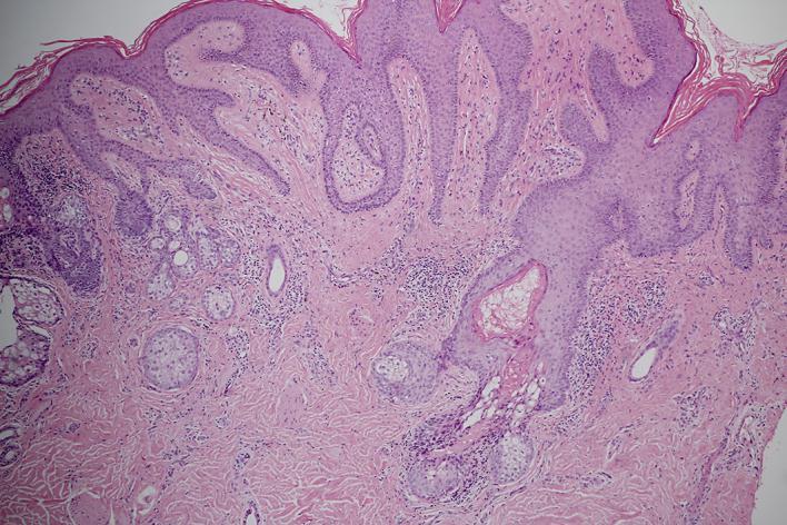 https://cdn.ncbi.nlm.nih.gov/pmc/blobs/0409/4868933/935f3d0bcec2/cde-0008-0080-g02.jpg