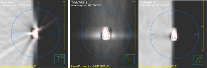 https://cdn.ncbi.nlm.nih.gov/pmc/blobs/0413/4775828/05d726cc8ad8/JMRS-63-48-g002.jpg