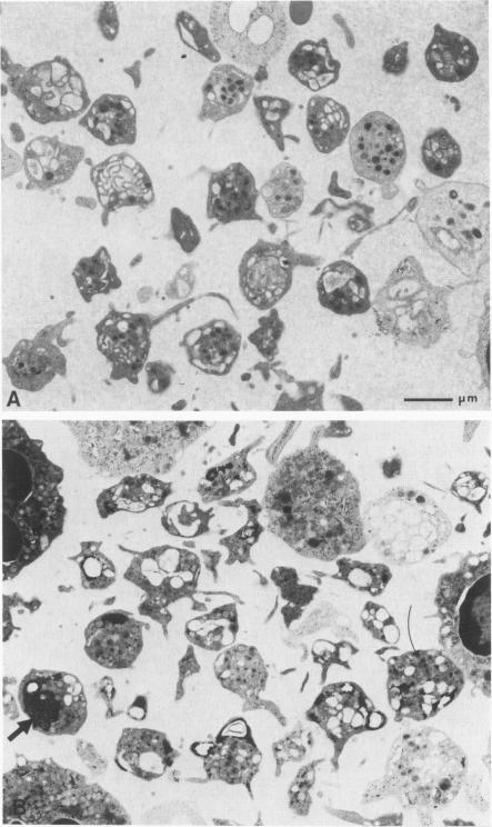 https://cdn.ncbi.nlm.nih.gov/pmc/blobs/0415/1903815/d7bdb3e47995/amjpathol00217-0127-a.jpg