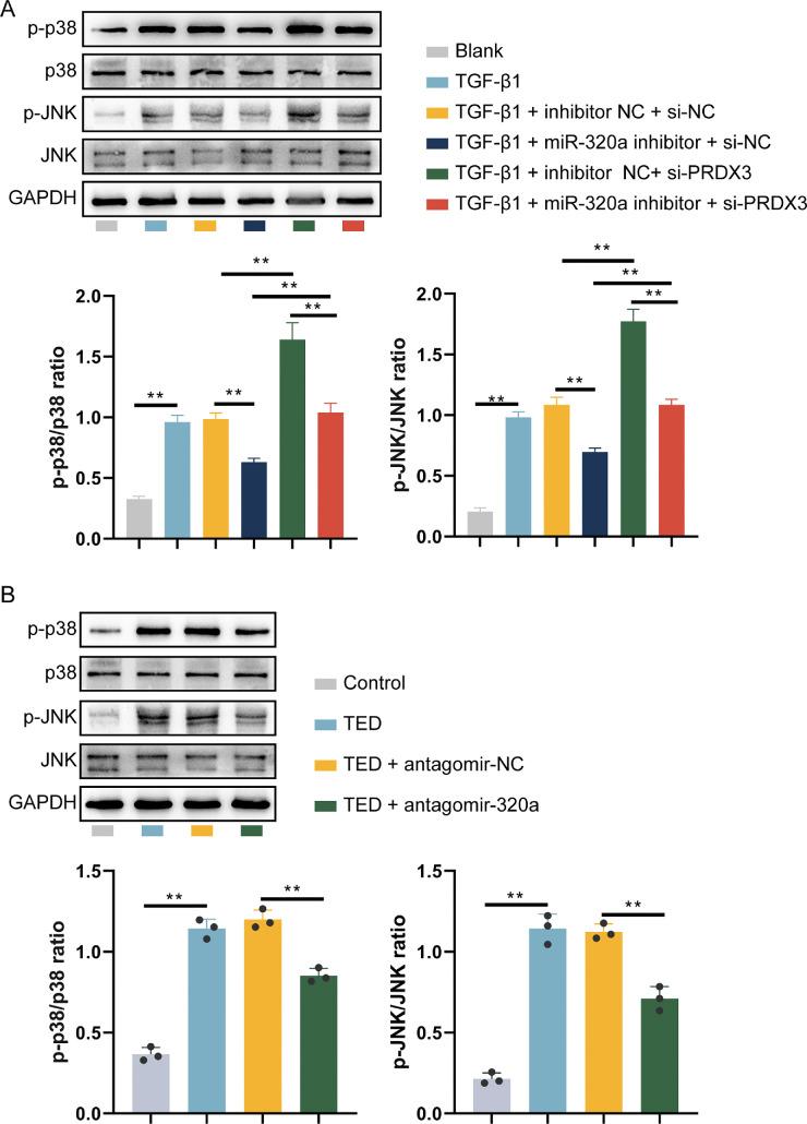 https://cdn.ncbi.nlm.nih.gov/pmc/blobs/041a/12270022/cb0787216888/iovs-66-9-41-f008.jpg