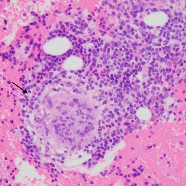 https://cdn.ncbi.nlm.nih.gov/pmc/blobs/041f/8532072/48d341a13b48/amjcaserep-22-e933272-g002.jpg