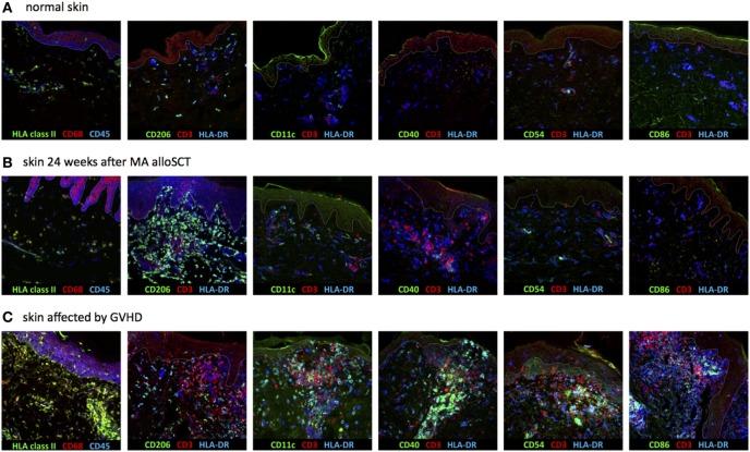 https://cdn.ncbi.nlm.nih.gov/pmc/blobs/0420/5835032/9bb9decd3599/fimmu-09-00331-g004.jpg
