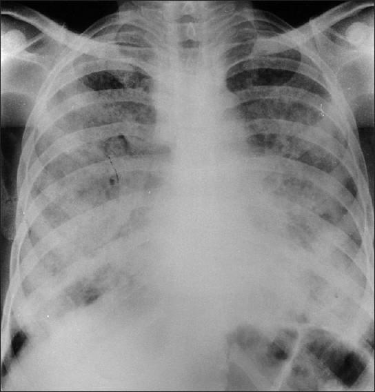 https://cdn.ncbi.nlm.nih.gov/pmc/blobs/0424/2876706/6fa4e468fd66/LI-26-152-g001.jpg