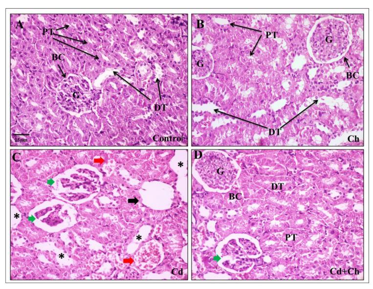 https://cdn.ncbi.nlm.nih.gov/pmc/blobs/0429/10525457/bb7cd5df5fc7/biomedicines-11-02414-g004.jpg