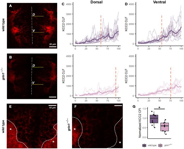 https://cdn.ncbi.nlm.nih.gov/pmc/blobs/0429/10858180/a265418891af/41598_2024_53910_Fig8_HTML.jpg