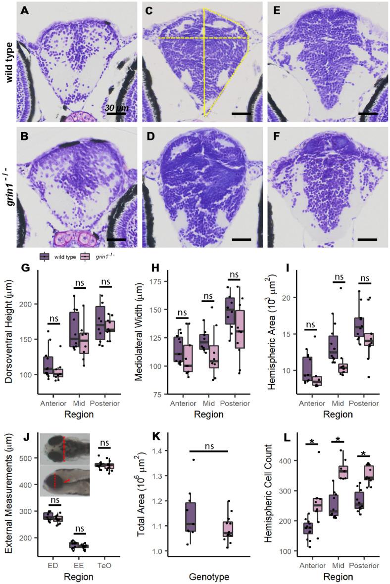 https://cdn.ncbi.nlm.nih.gov/pmc/blobs/0429/10858180/beab6fc34e33/41598_2024_53910_Fig1_HTML.jpg