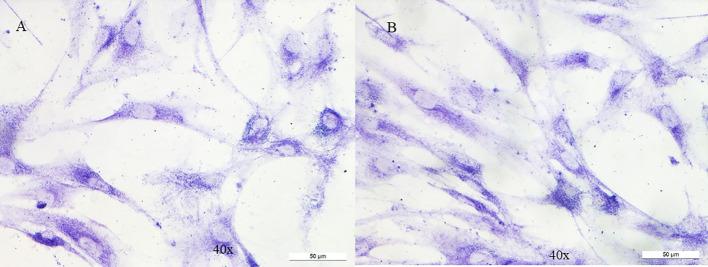 https://cdn.ncbi.nlm.nih.gov/pmc/blobs/042a/10800918/ebbd60b48b86/fonc-13-1324013-g002.jpg
