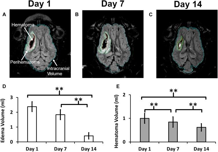 https://cdn.ncbi.nlm.nih.gov/pmc/blobs/042b/6712426/994f8f2bfc15/fnins-13-00888-g001.jpg