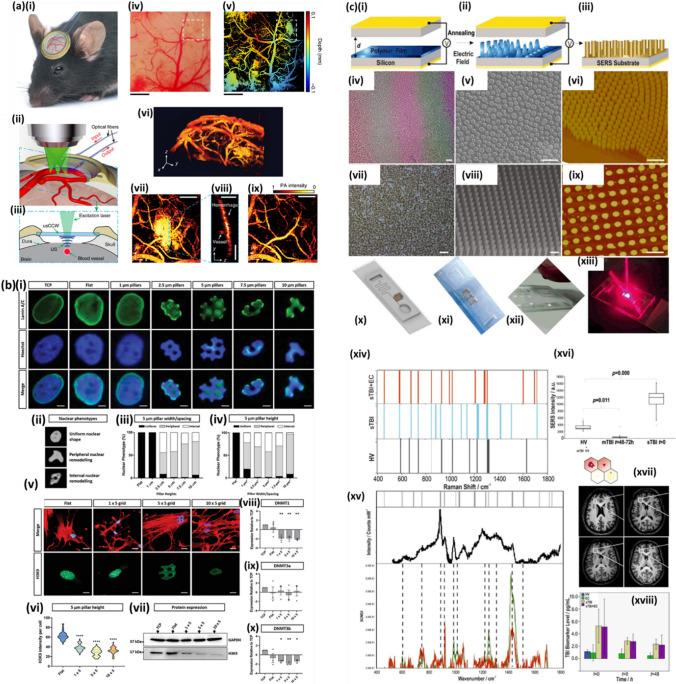 https://cdn.ncbi.nlm.nih.gov/pmc/blobs/0431/10713959/be74624db529/11671_2023_3938_Fig5_HTML.jpg