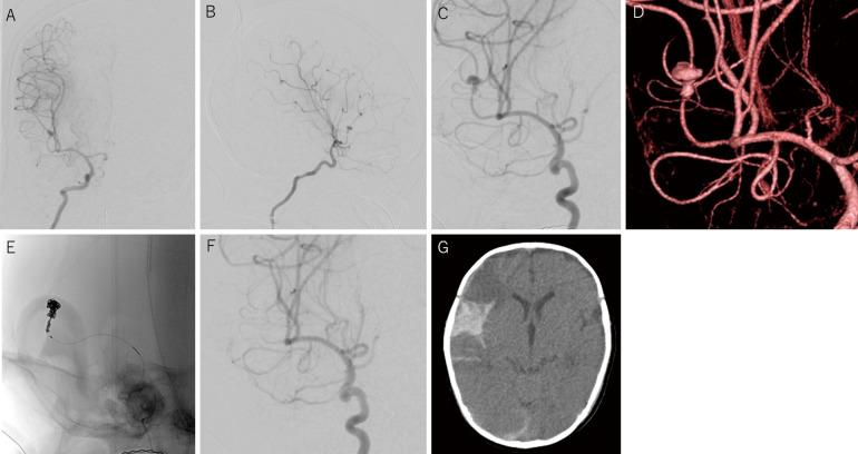 https://cdn.ncbi.nlm.nih.gov/pmc/blobs/0440/10351959/9d1f395bac7f/2188-4226-10-0177-g002.jpg