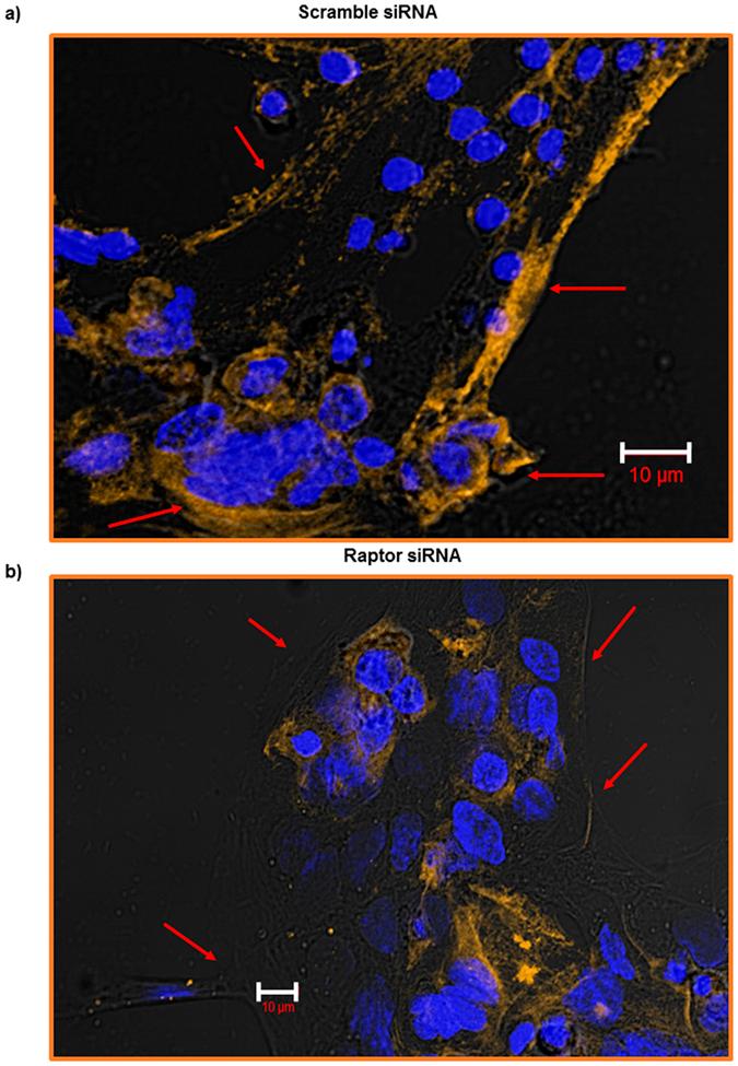 https://cdn.ncbi.nlm.nih.gov/pmc/blobs/0447/4999868/e6ef076f1bdb/srep31705-f7.jpg