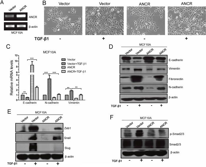 https://cdn.ncbi.nlm.nih.gov/pmc/blobs/0447/5620176/cbf2fbe4a6c7/oncotarget-08-67329-g002.jpg