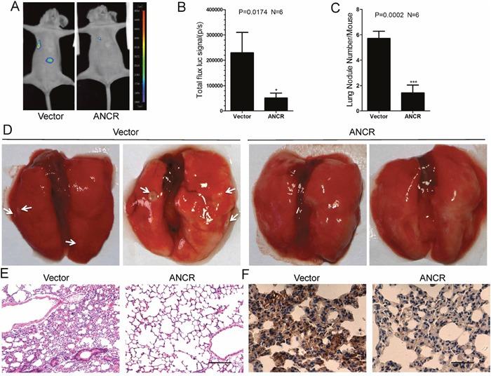 https://cdn.ncbi.nlm.nih.gov/pmc/blobs/0447/5620176/d05314f08c5e/oncotarget-08-67329-g007.jpg