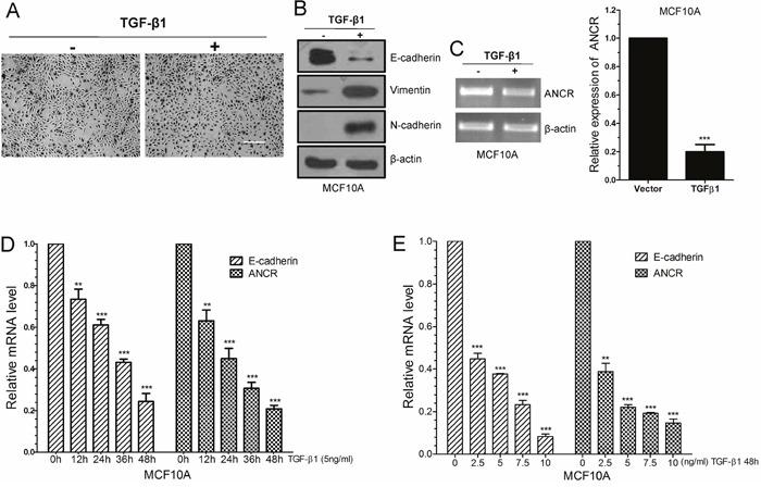 https://cdn.ncbi.nlm.nih.gov/pmc/blobs/0447/5620176/e33329863294/oncotarget-08-67329-g001.jpg
