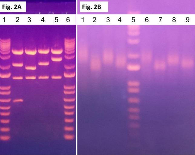 https://cdn.ncbi.nlm.nih.gov/pmc/blobs/044c/10954730/be4d6192f5d6/41598_2024_54941_Fig2_HTML.jpg