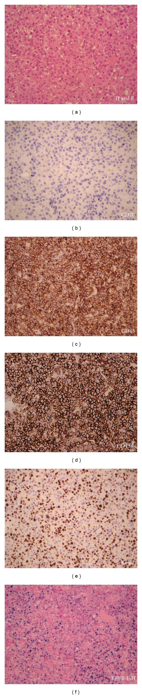 https://cdn.ncbi.nlm.nih.gov/pmc/blobs/0452/3580916/20eadbe83410/CRIM.HEMATOLOGY2013-541783.002.jpg