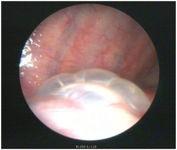https://cdn.ncbi.nlm.nih.gov/pmc/blobs/0457/7887667/c22e4c868a1a/10.1177_1753466620986390-fig1.jpg