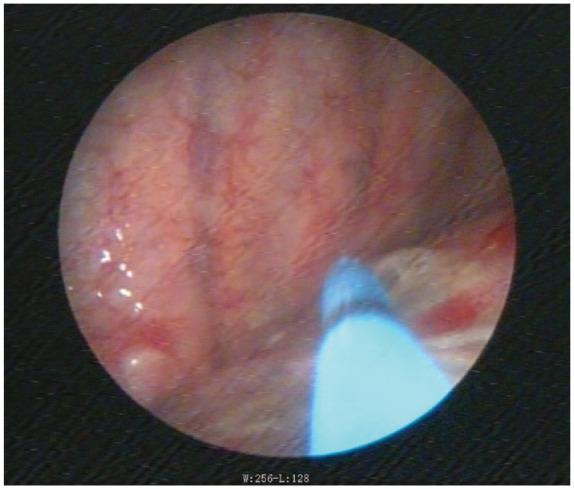 https://cdn.ncbi.nlm.nih.gov/pmc/blobs/0457/7887667/e51e0cfc117d/10.1177_1753466620986390-fig2.jpg