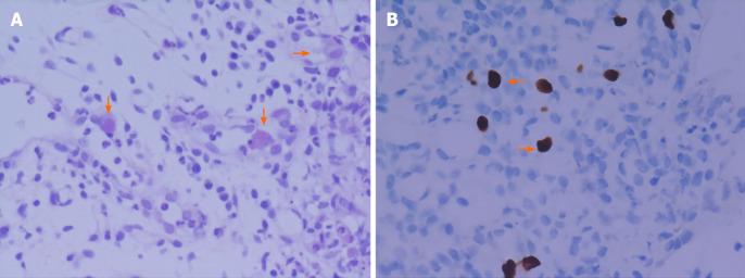 https://cdn.ncbi.nlm.nih.gov/pmc/blobs/0462/8058656/17ddcff02f96/WJG-27-1655-g004.jpg