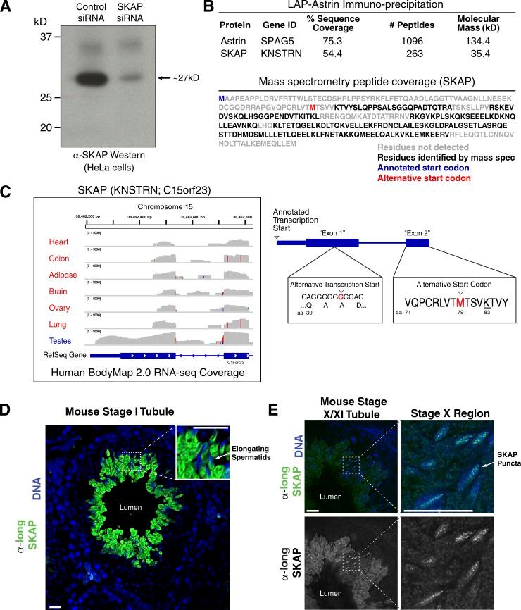 https://cdn.ncbi.nlm.nih.gov/pmc/blobs/0467/4862331/c4805ef2a6f0/JCB_201510117_Fig1.jpg