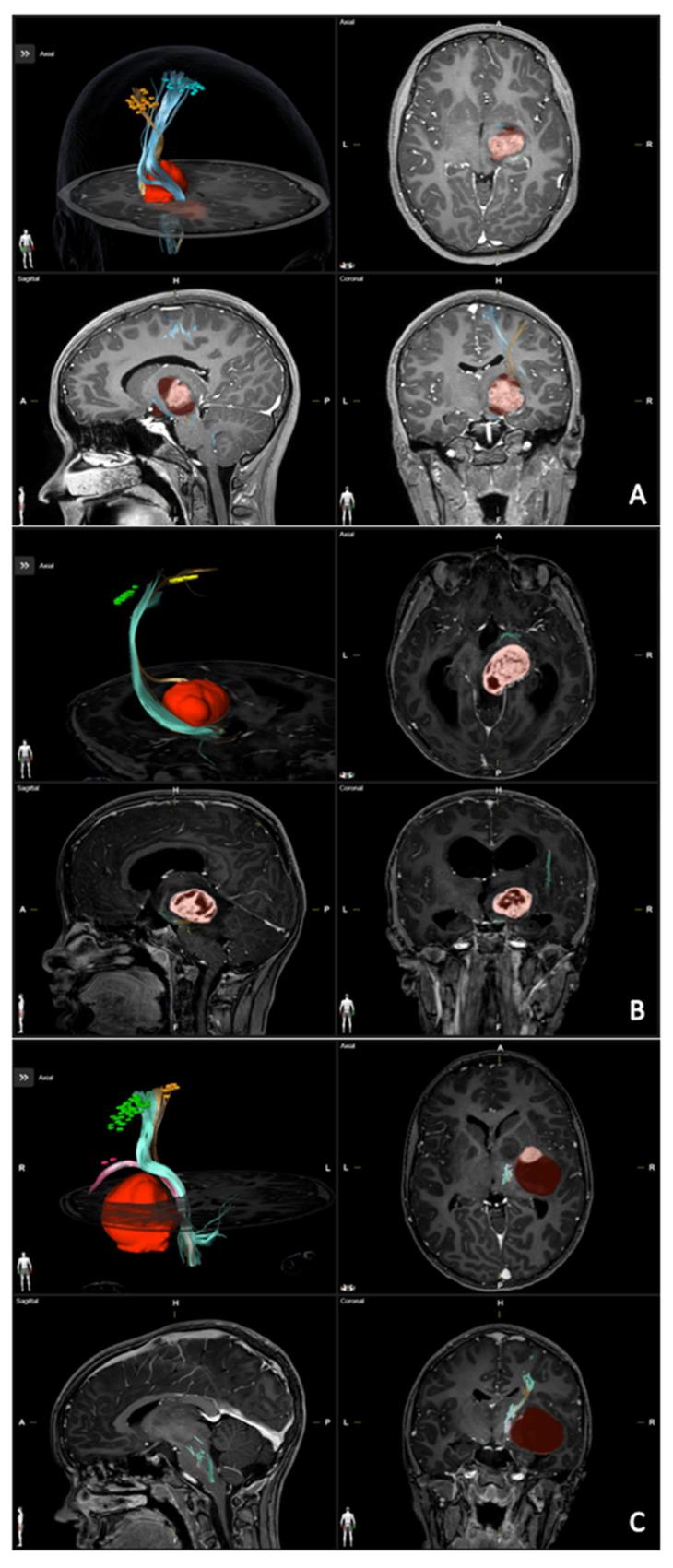 https://cdn.ncbi.nlm.nih.gov/pmc/blobs/0468/9954590/331fc60a5bb0/brainsci-13-00234-g002.jpg