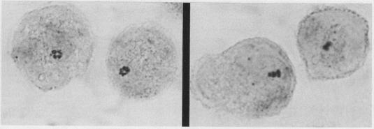 https://cdn.ncbi.nlm.nih.gov/pmc/blobs/046c/463491/dc6c787b6c46/thorax00360-0017-a.jpg