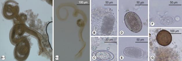 https://cdn.ncbi.nlm.nih.gov/pmc/blobs/0472/6046551/bc8c2daa9280/kjp-56-3-301f1.jpg