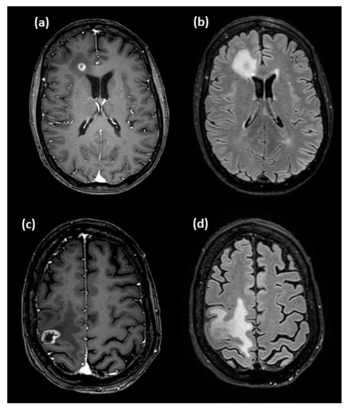 https://cdn.ncbi.nlm.nih.gov/pmc/blobs/0474/11989814/69637bf6a8ef/jcm-14-02168-g007.jpg