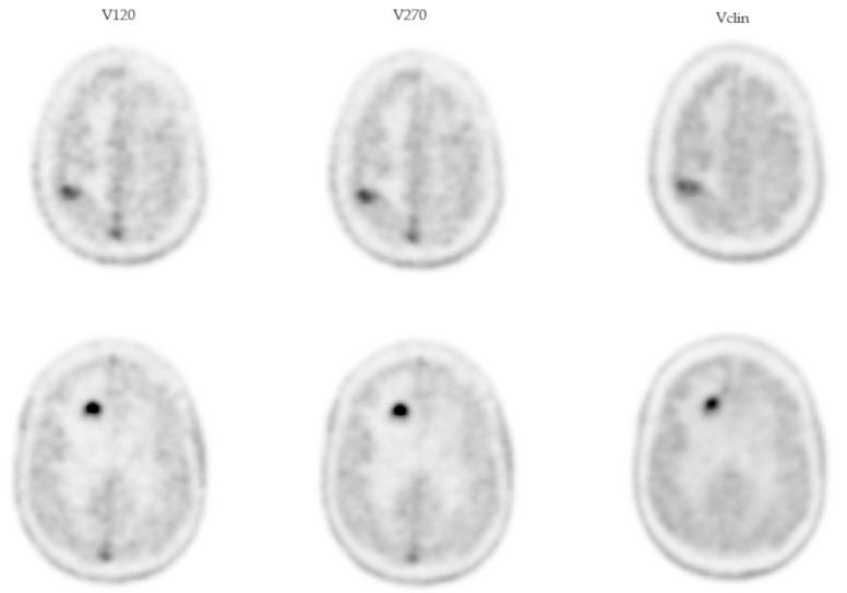 https://cdn.ncbi.nlm.nih.gov/pmc/blobs/0474/11989814/74e3f1d8f195/jcm-14-02168-g005.jpg