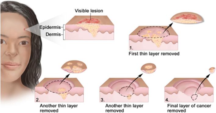 https://cdn.ncbi.nlm.nih.gov/pmc/blobs/0476/10559482/d6c74d880278/12943_2023_1854_Fig5_HTML.jpg
