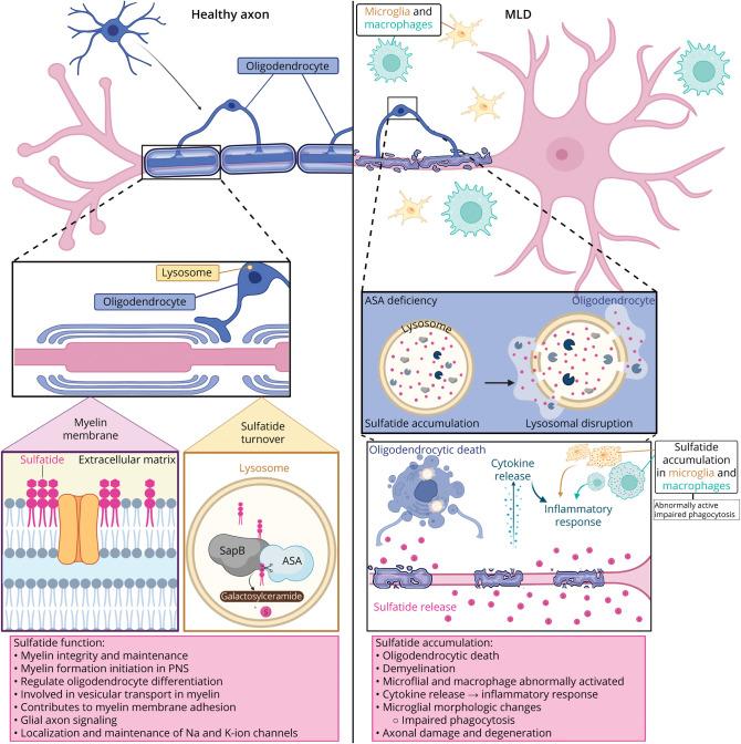 https://cdn.ncbi.nlm.nih.gov/pmc/blobs/047a/12205745/dcd23d8adffa/WNL-2025-200405f2.jpg