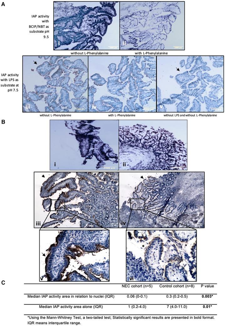 https://cdn.ncbi.nlm.nih.gov/pmc/blobs/0480/11091495/29c125af02f3/fped-12-1401090-g002.jpg