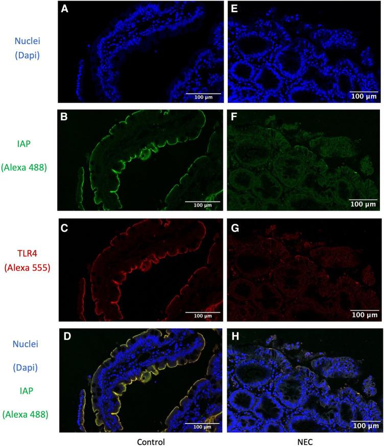 https://cdn.ncbi.nlm.nih.gov/pmc/blobs/0480/11091495/ff8990dc5c4c/fped-12-1401090-g003.jpg