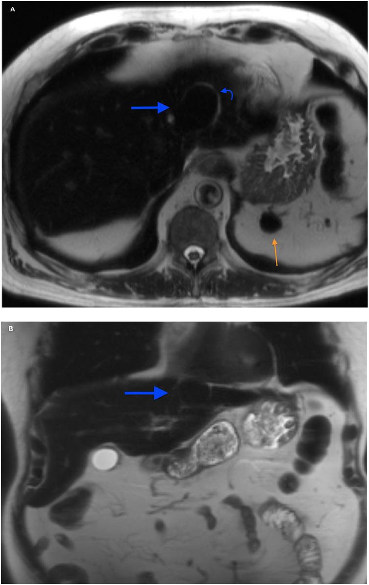 https://cdn.ncbi.nlm.nih.gov/pmc/blobs/0487/8259227/4f62052c15f7/gr3.jpg