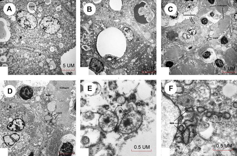 https://cdn.ncbi.nlm.nih.gov/pmc/blobs/0488/7722493/2704ec218e42/gr3_lrg.jpg
